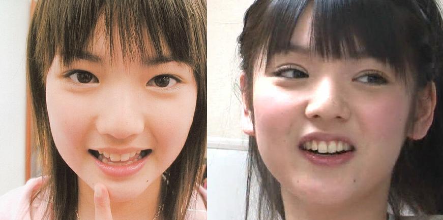 Av女優 モーニング娘 の子とか狂ったようにお直しに来る 整形を暴露 芸能裏ブログ